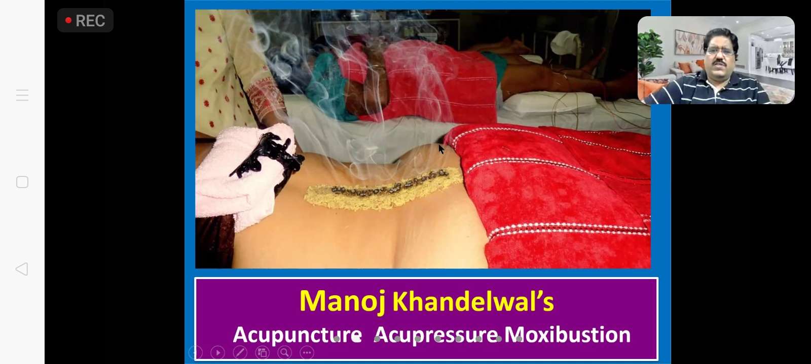 Moxibustion